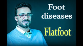 05 Foot diseases: Flatfoot