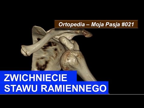 Zwichnięcie stawu ramiennego (barku?) | OMP#021