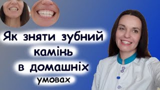 Як зняти зубний наліт і зубний камінь в домашніх умовах народними методами і відбілити зуби за 5 хв