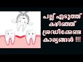 Care to be taken after Tooth Extraction# pallu eduthathinu seshom sradhikendava | Tooth removal