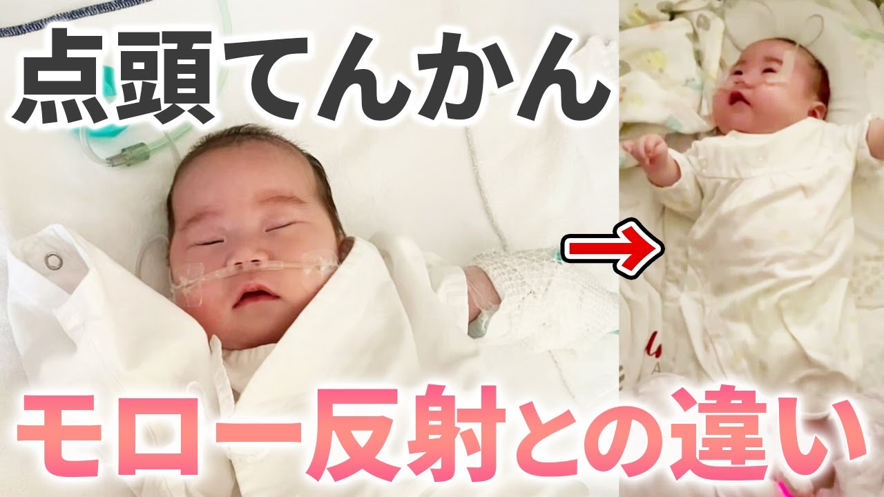 点 頭 てんかん うなずく 動画