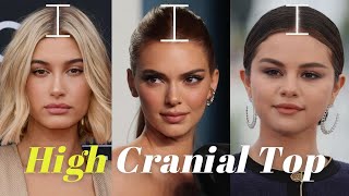 Best Hairstyles for High Cranial Top
