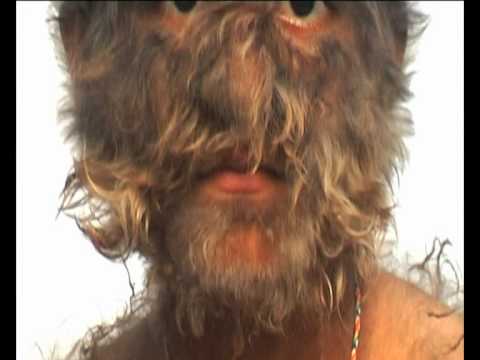 Video: Hypertrichosis: Tegn, Behandling, Fotos, årsager