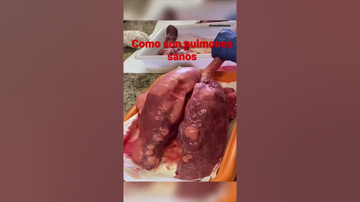Unos pulmones 🫁 sanos.Como se hinchan lis pulmones sololando.#pulmones #shorts #reels #tiktok