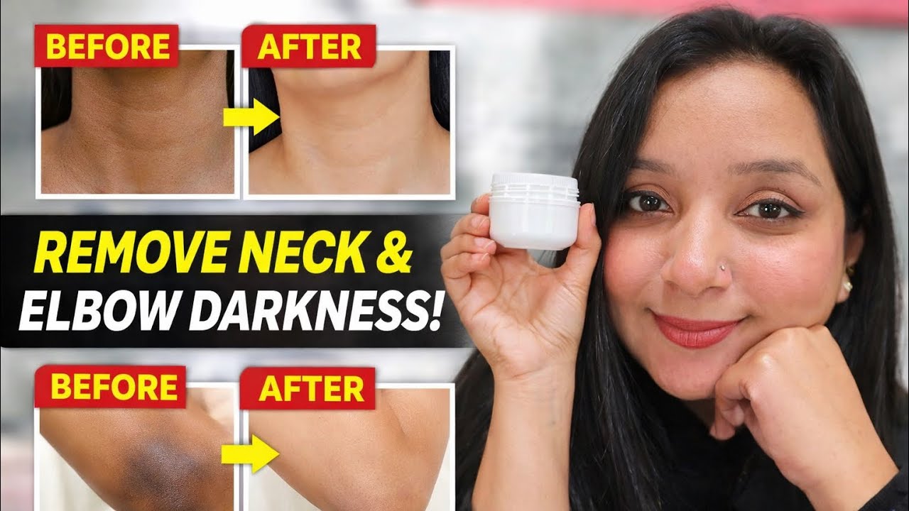 Dark Neck & Elbow Treatment 🫣| Amazon Best Cream for Dark Neck & Elbows? Truth Revealed 😵‍💫🙄