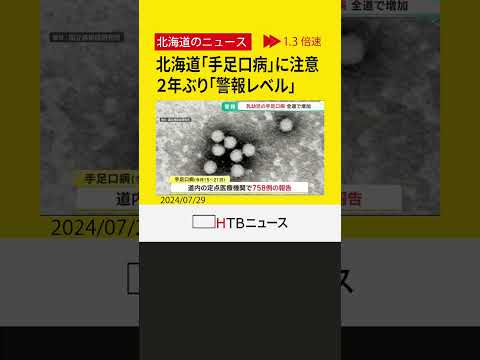 北海道内広域で「手足口病」２年ぶり警報レベル　今月15～21日にかけて758例報告　感染対策呼びかけ