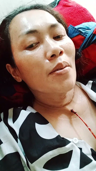 5 setelah operasi tiroid