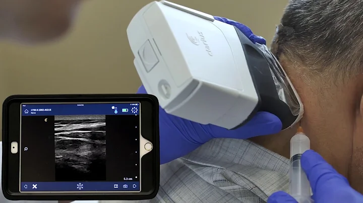 Ultrasound Guided Nerve Block by Dr. David Rosenbl...
