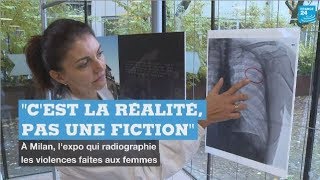 Violences conjugales : l'exposition choc d'un hôpital de Milan