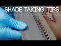 Shade Taking Tips for E.MAX Restorations