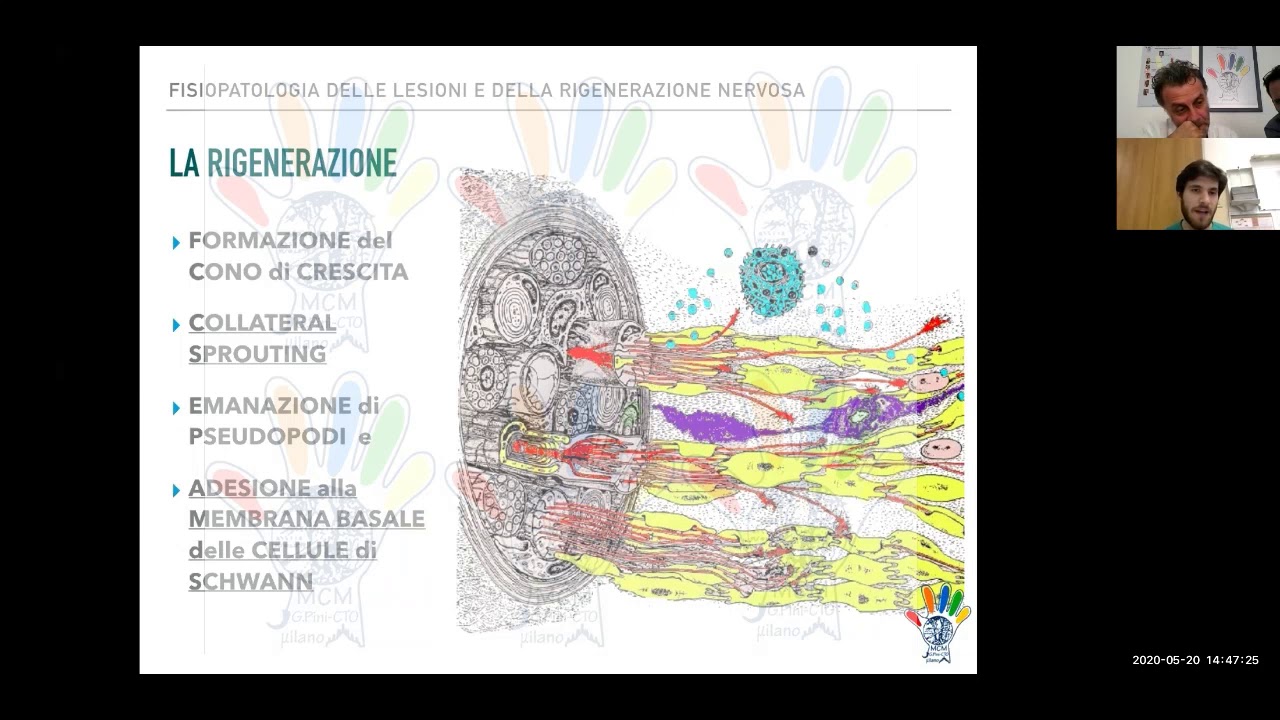 Fisiopatologia della lesione e della rigenerazione nervosa