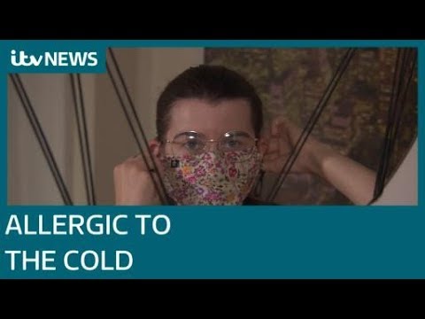 Video: Cold allergy. The woman suffers from a rare disease