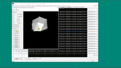 MEG/EEG Time Frequency Analysis 09