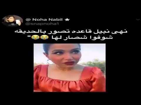 انا متاكد انهم يطالعوا على خيبته وبشاعته روحي اعملي لك عملية تجميل احسن