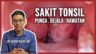 Sakit Tonsil (Acute Tonsillitis). Rawatan dan Cara Hilangkan Sakit Tonsil di Rumah.