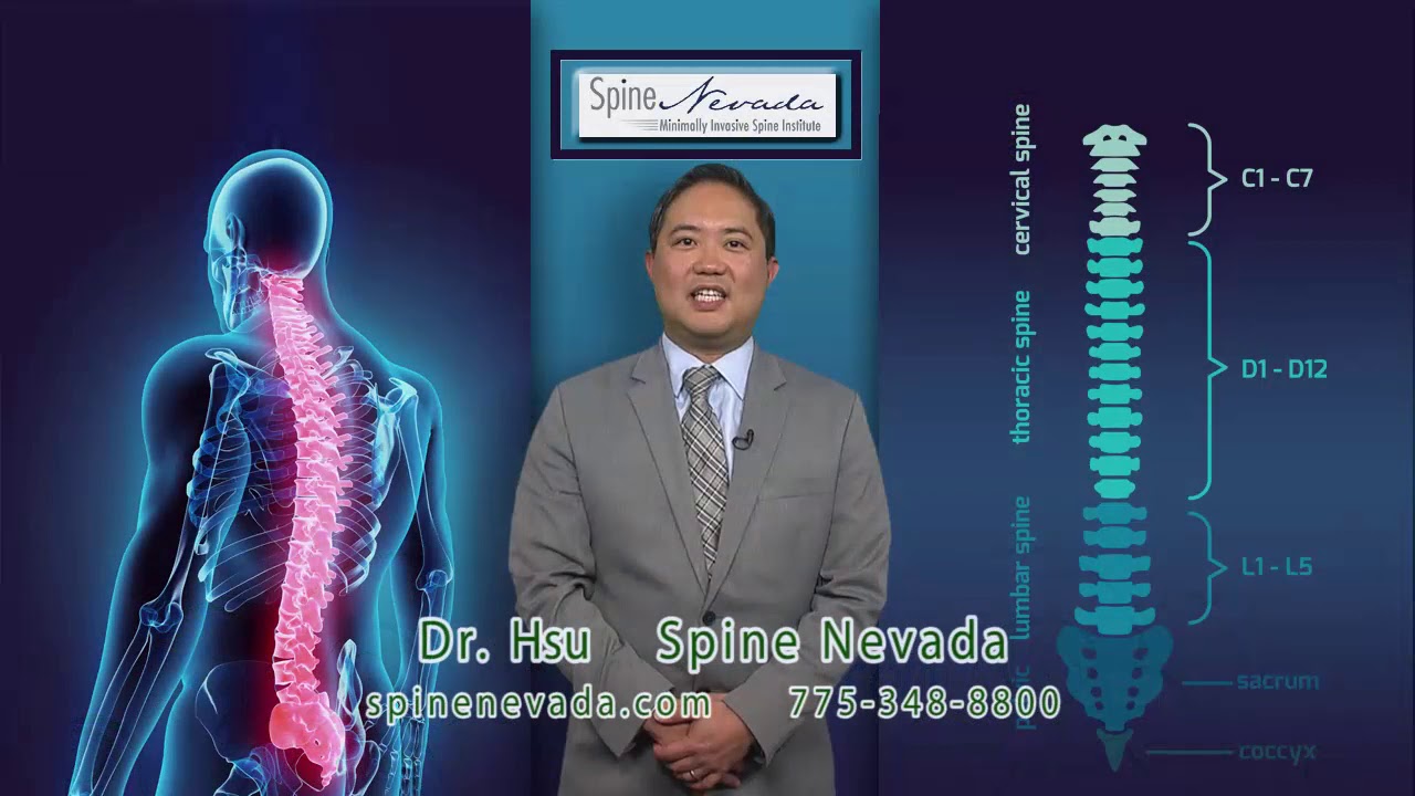 Spine Health prevention tips from Dr. Andrew Hsu at Spine Nevada in Reno