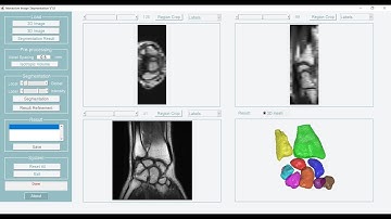 2D and 3D Interactive Image Segmentation Free Software (Medical Images)