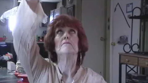 Linda one month post Liberation procedure