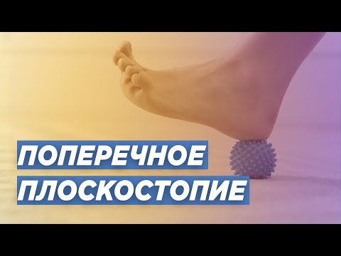 ПОПЕРЕЧНОЕ ПЛОСКОСТОПИЕ. ДОКТОР ТРАВМАТОЛОГ-ОРТОПЕД ИГОРЬ ПАХОМОВ.