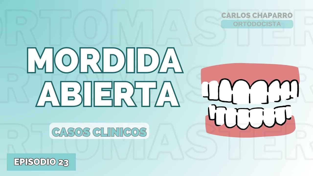 Mordidas abiertas 😃 - Episodio 23