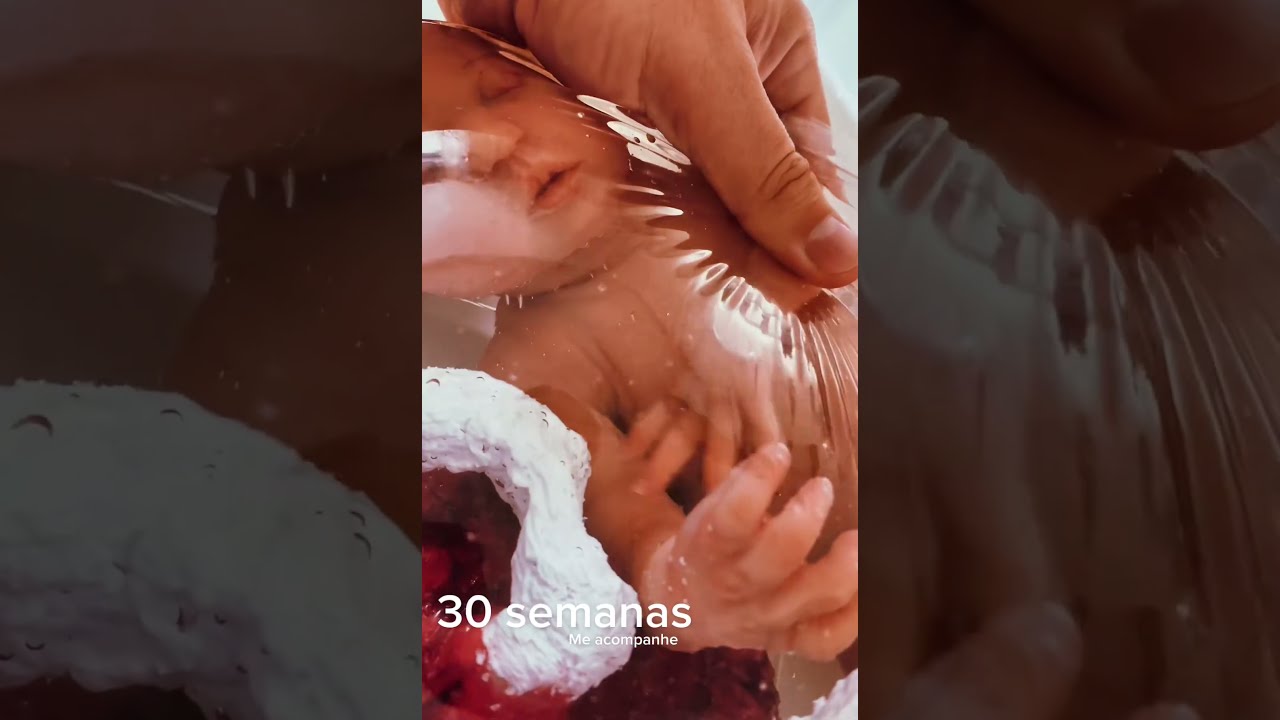 This is how a  30 weeks baby in amniotic sac🤰