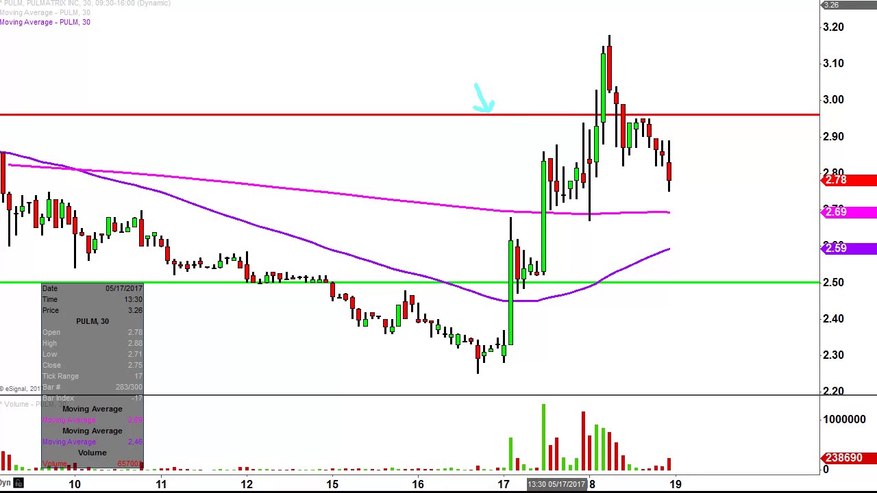 Pulm Chart