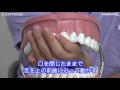口輪筋マッサージで口呼吸を改善する　口腔ケアチャンネル　373（口腔ケアチャンネル2　#046）