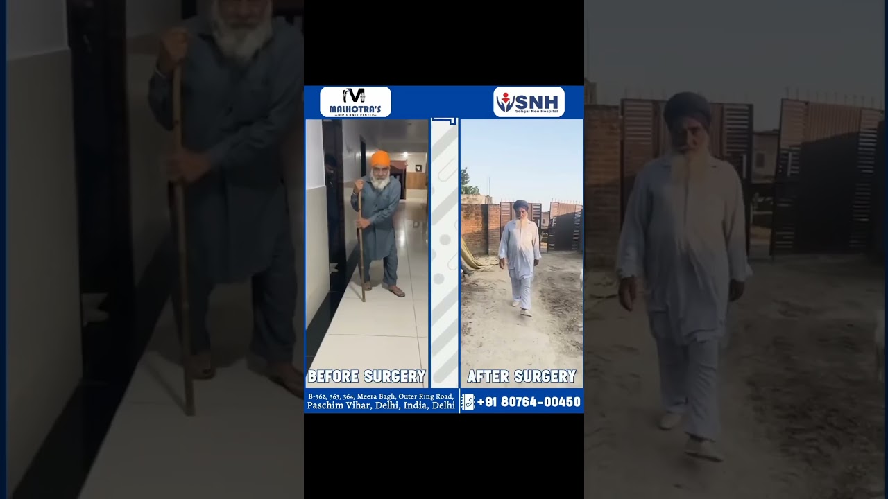 Life changes after robotic total knee replacement