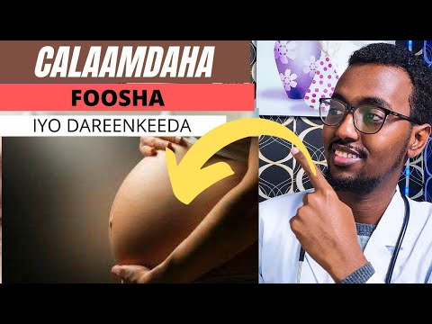 SI FUDUD KU BARO CALAAMADAHA FOOSHA IYO DAREENKEEDA