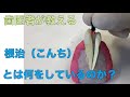 根治の説明動画① 根治とは何をしている治療なのか？