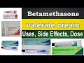 betamethasone valerate cream, betamethasone cream uses in hindi, pregnancy, Uses, Side Effects, Dose