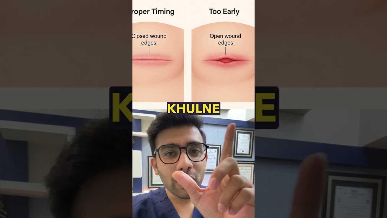 🛑 7 to 10 Day Rule About Gyno Stitches Removal. Best Results Gynecomastia Surgery. Dr DC, Pune