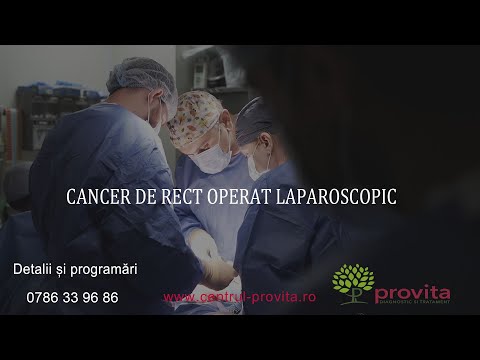 Rezectie recto joasa cu anastomoza - Cancer de rect operat laparoscopic