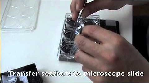 Sectioning low-melting-point agarose (LMA)-embedded tissue and mounting near-native sections.