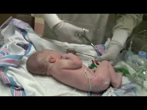 Newborn Baby Helps Doctor Cut Umbilical Cord