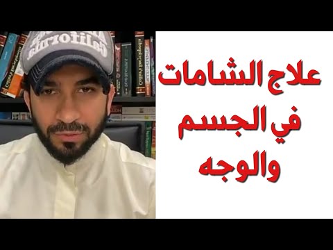 ظهور الشامات في الجسم والوجه دكتور طلال