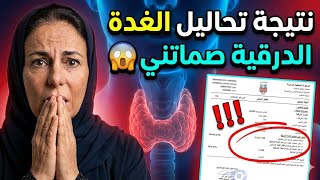 معجزة ربانية 🤲التحاليل الغذة الذرقية  صدماتني😱 والطبيبة وقفات عاجزة قدام التحاليل 😰