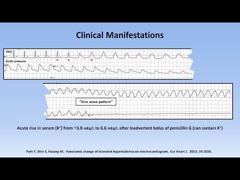 Video: Penyakit Gamstorp (Kelumpuhan Berkala Hyperkalemic)
