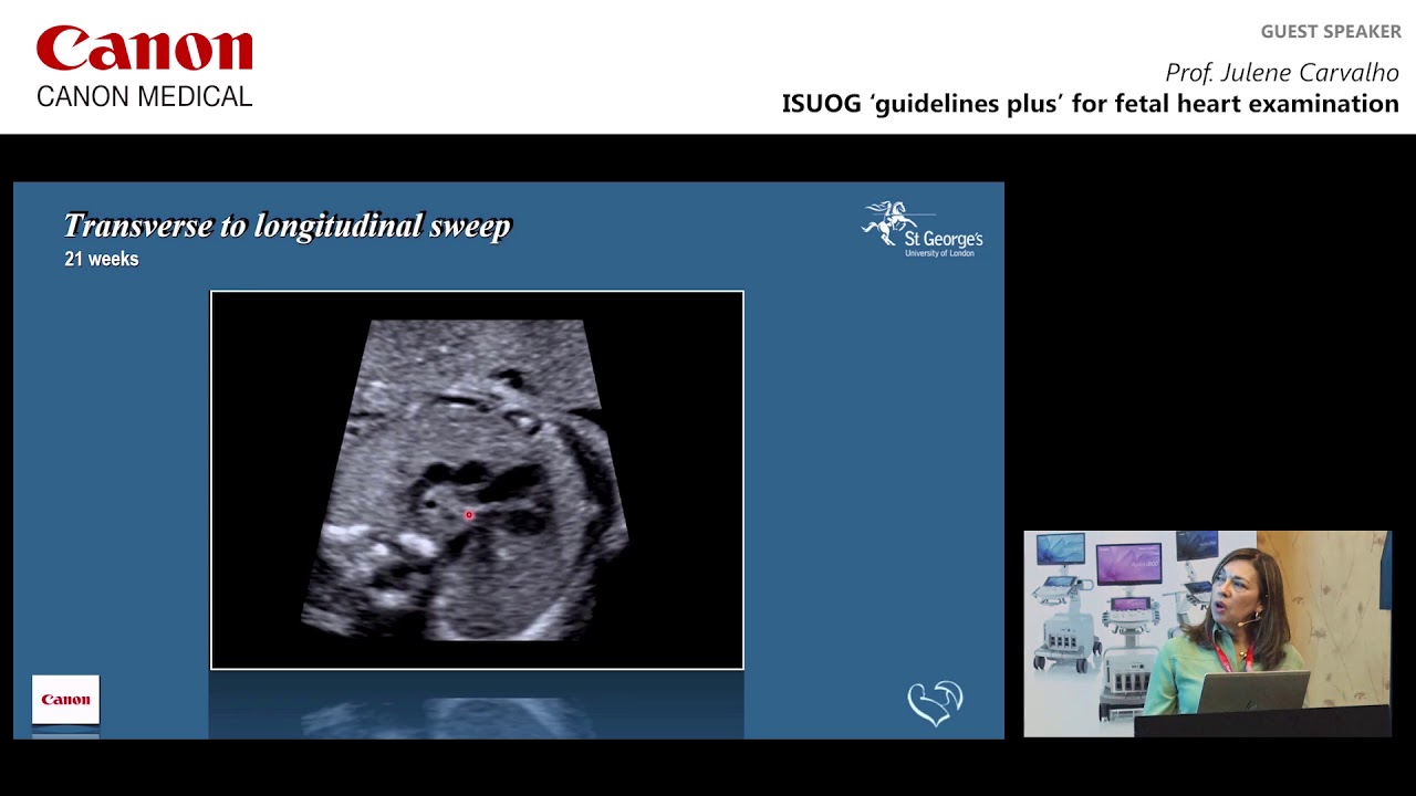 ISUOG 2018 Prof. Julene Carvalho - 'Guidelines Plus' for Fetal Heart Examination