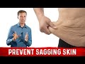 How To Prevent Sagging Skin with Losing Weight? - Dr.Berg On Loose Skin After Weight Loss