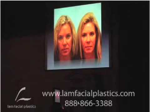 Fat Grafting Lecture, Contemporary Surgery Of The Aging Face, St. Louis, Mo, 2007