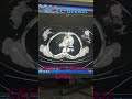 CECT Chest & Abdomen (Ca. Lt Breast)