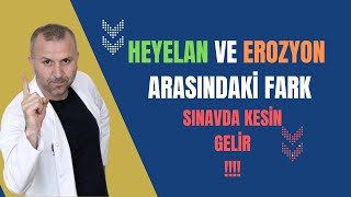 HEYELAN VE EROZYON ARASINDAKİ FARK #tytcoğrafya #coğrafya #tyt #ayt #yks #kpss Resimi