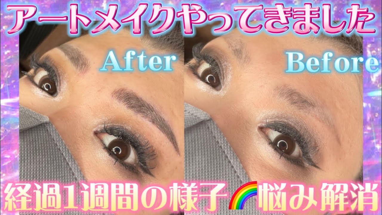 Art makeup] Progress report from 1 week to 1 year after art