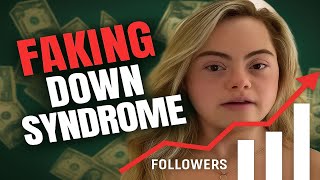 She Is Faking Down Syndrome For Views...