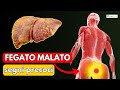 Fegato: 10 sintomi di qualcosa che non va