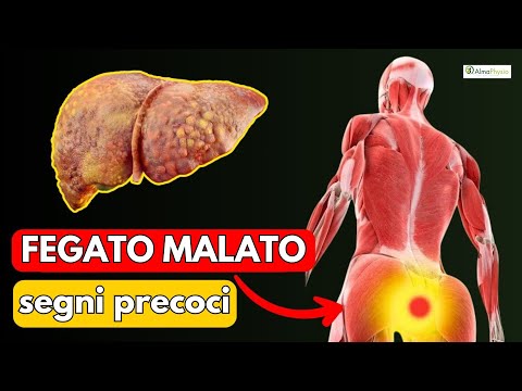 Fegato: 10 sintomi di qualcosa che non va