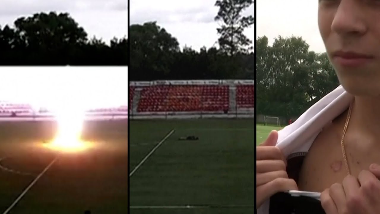 16 Year Old Soccer Goalie Is Struck by Lightning