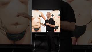 Breast Implants and Liposuction in Miami | What to Expect