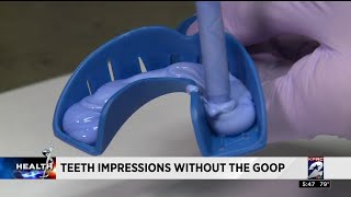 A new way to take dental impressions